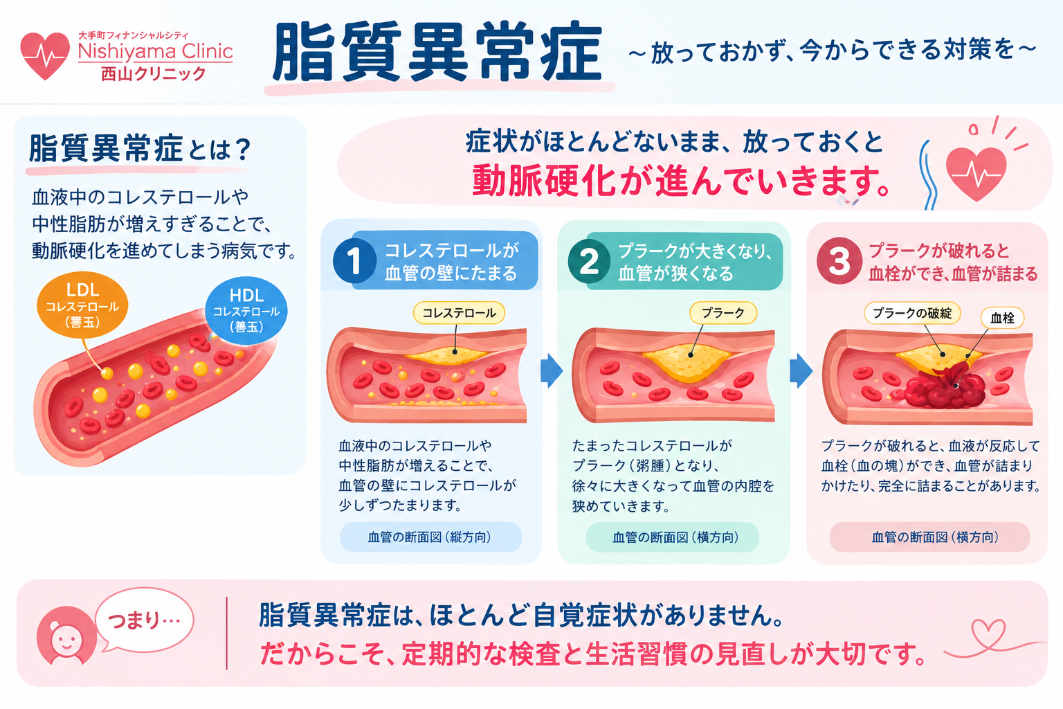 脂質異常症と動脈硬化の進行 ।.png